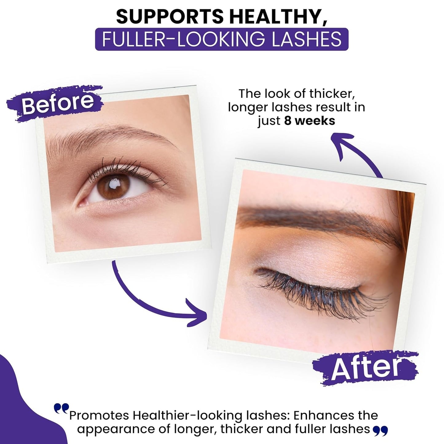 RapidLash® Eyelash Enhancing Serum